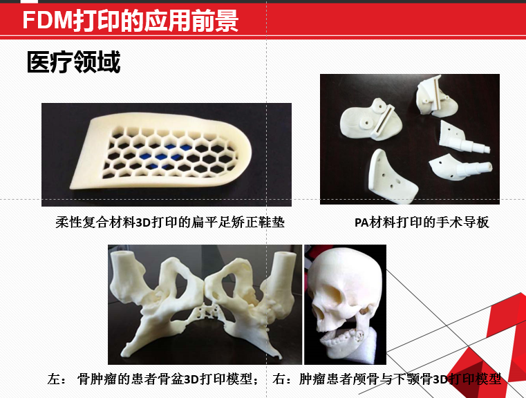 FDM 技術(shù)3D打印機(jī)應(yīng)用領(lǐng)域廣泛，在可預(yù)見的未來無可估量！