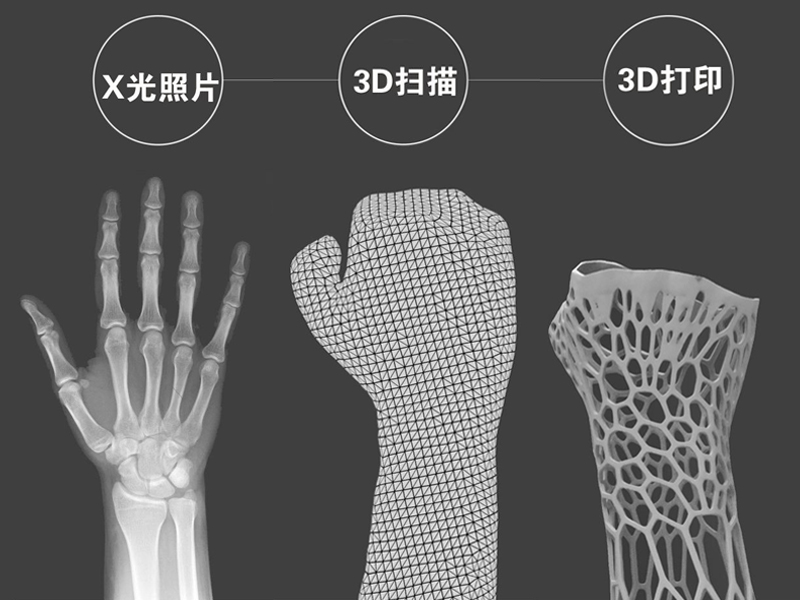 陜西非凡士分享FDM3D打印在醫(yī)療行業(yè)的應用案例